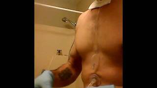 How to Clean your Feeding tube (Percutaneous endoscopic gastrostomy )