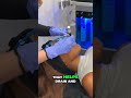 Hydrafacials are fantastic for black and brown skin, providing a deep cleanse and hydration boost