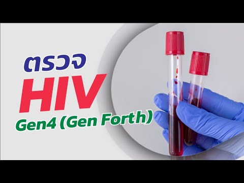 ตรวจการติดเชื้อ HIV แบบการตรวจแบบ 4th Gen Forth Gen