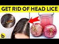 Home Remedies To Get Rid Of Head Lice