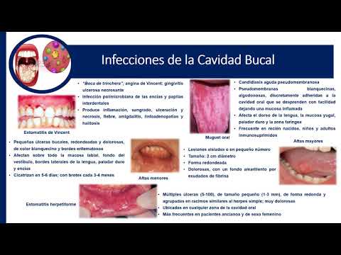 Tema 3 Infecciones de Cavidad Bucal - YouTube