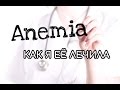 Анемия. Как лечить. Симптомы. Анализы. ФГС. Капельница.Таблетки. Выпадение волос #анемия