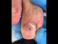 Gentle Toenail Trim | Relaxing Foot Care Routine #nails #footcare #pedicure