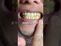 このどす黒い歯磨き粉がすごかった#自分磨き #歯 #ホワイトニング #歯磨き粉 #美容 pr