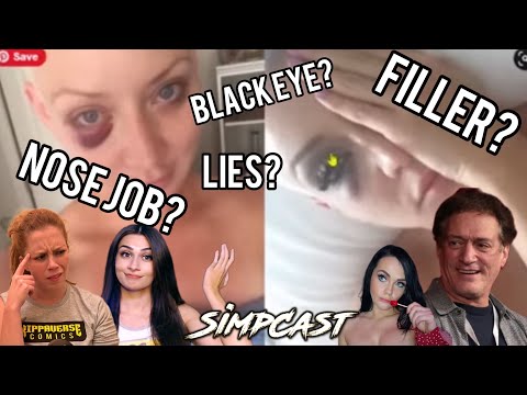 Is Eliza Bleu LYING About "Black Eyes"? Anthony Cumia, Chrissie Mayr Anna TSWG & SimpCast Speculate