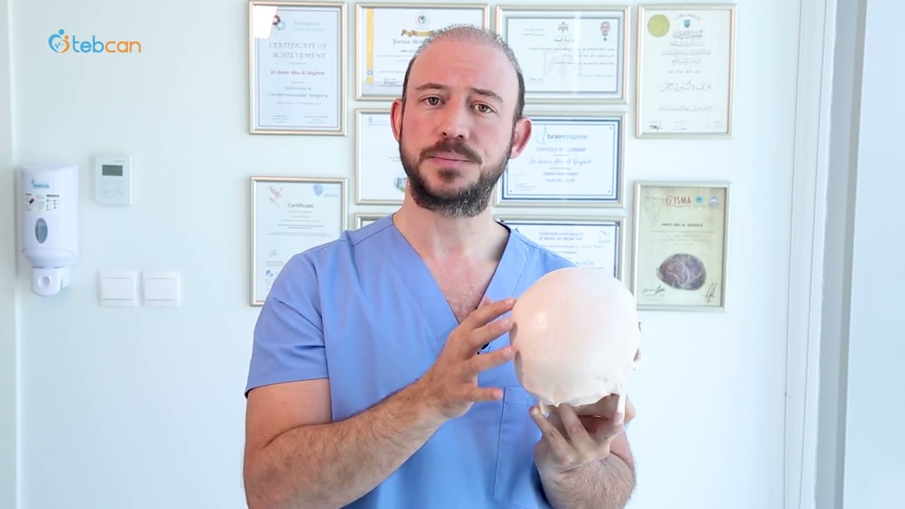 الدكتور عامر أبو الراغب - أخصائي جراحة الدماغ والاعصاب في الأردن - إلتهاب العصب القذالي - طبكان