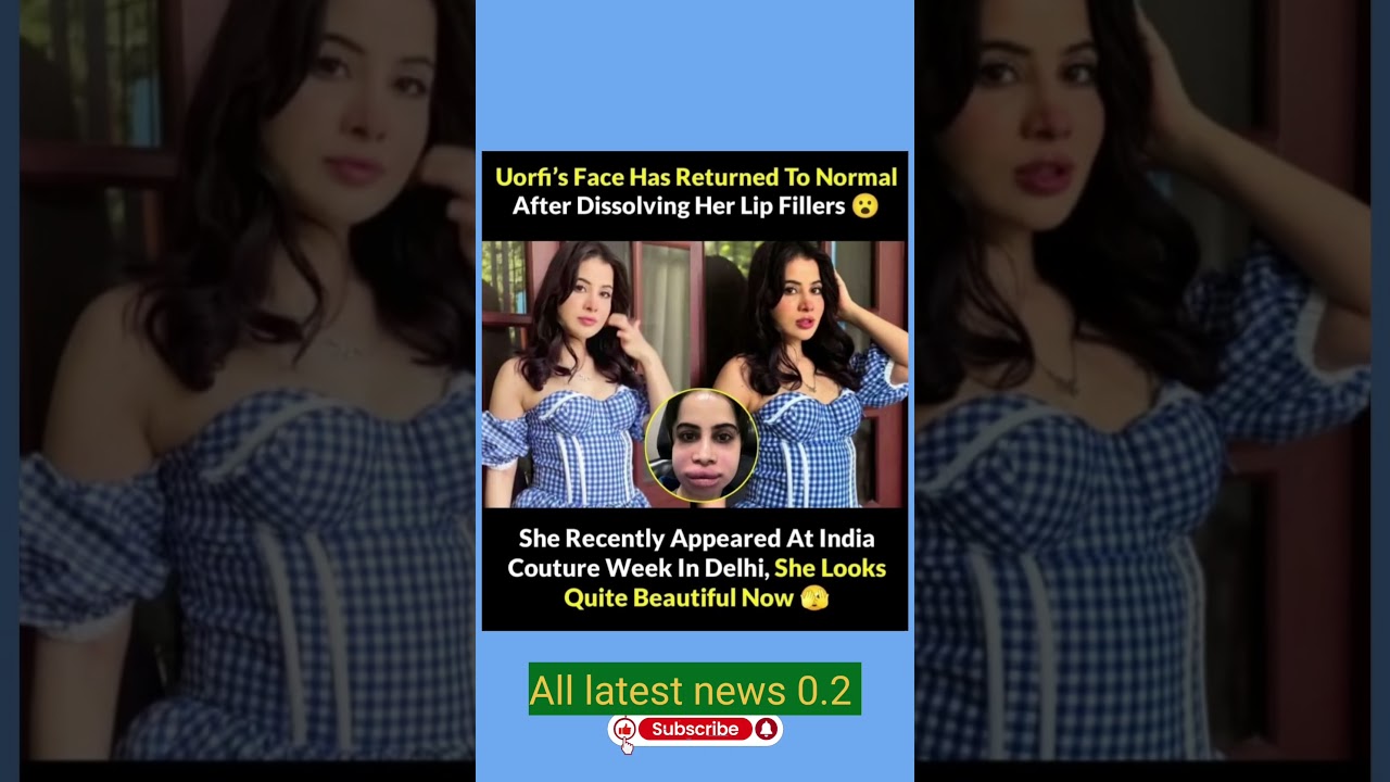 Uorfi's# Face Has Returned To Normal