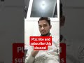 patient #admit#medicalprocedure #viral#like
