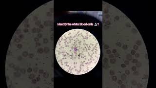 Hematology.......like , Comment, Hit The Bell