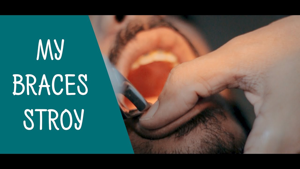 My Braces Story Mishkat khan ( The Fun Fin ) Struggling Year YouTube