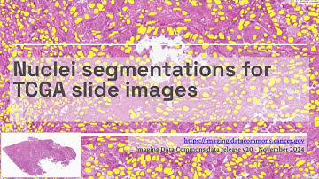 IDC v20 data release: New nuclei segmentation collection