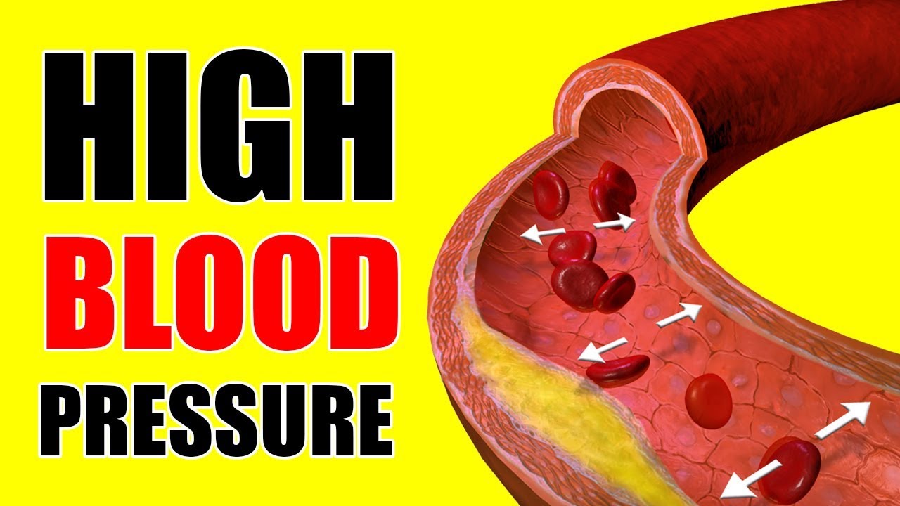 How To Lower Blood Pressure In The Morning Armandoalvarezdesign