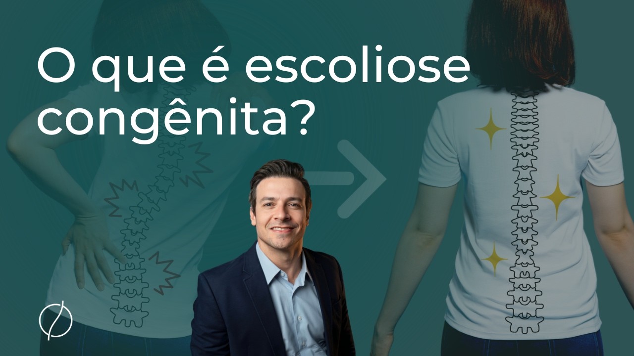 O que é escoliose congênita?