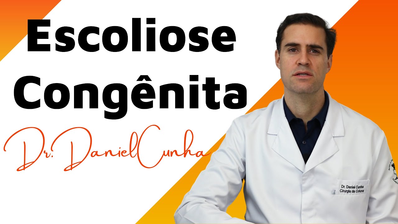 Escoliose Congênita - explicação simples mas completa sobre essa alteração