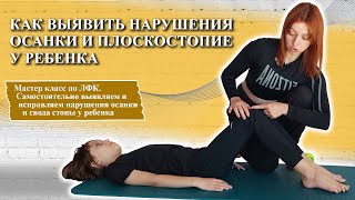 Курсы ЛФК | Обучение инструкторов ЛФК | 🌸Как выявить нарушения осанки и плоскостопие у ребенка❓