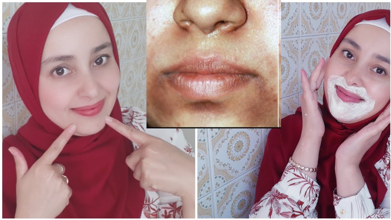 كيفية إزالة سواد حول الفم والتخلص من لإسمرار