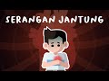 Bagaimana serangan jantung terjadi