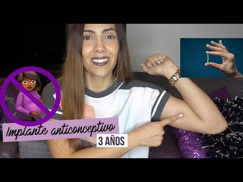 Mi experiencia con el Implante Anticonceptivo NEXPLANON 💉💉💉 I 3 años UPDATE