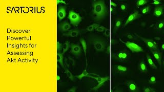 Famous Conference Presentation: Dynamic live-cell visualization and quantification of Akt activity Profile