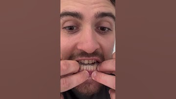 The product that everyone should know about ❤️ #teethwhiteningreview #amazon #smile #uk #funny