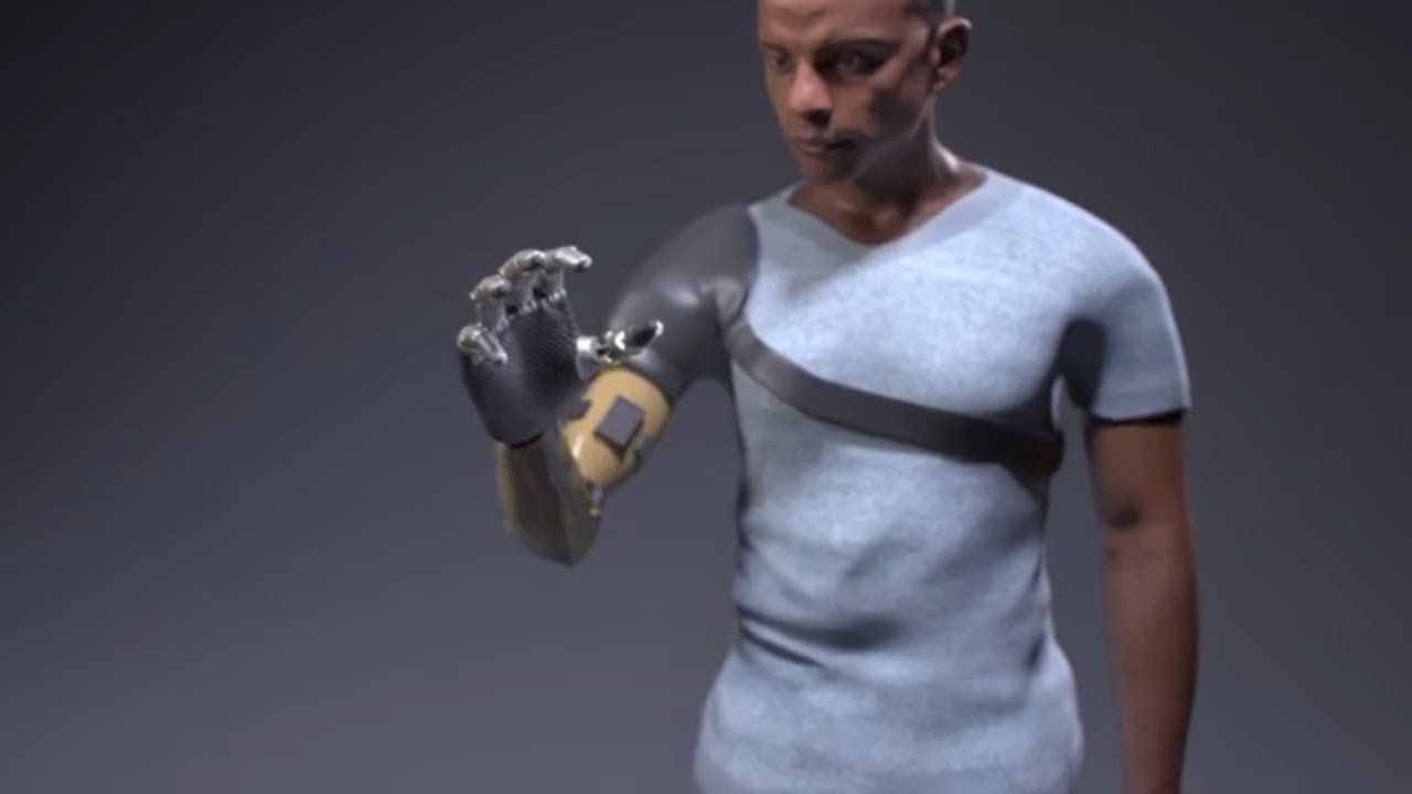 Bionic Arm That Restores Natural Movements, Sensation and Touch - YouTube