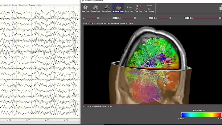 NeuroNavigator and EEG in Real-Time
