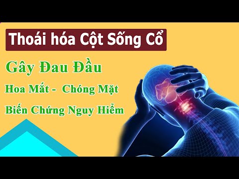 Video Bệnh Thoái Hóa Cột Sống Cổ Gây Đau Đầu Mất Ngủ Chóng... - youtube