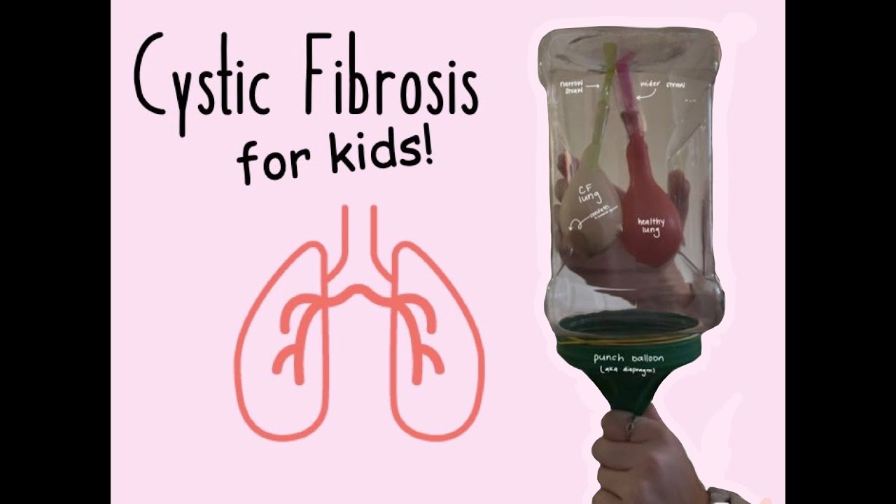 Cystic Fibrosis Teaching Tool for Children DIY Lung Function