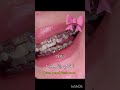 احلامي وانا صغير Blackpink اهميه شلتنا