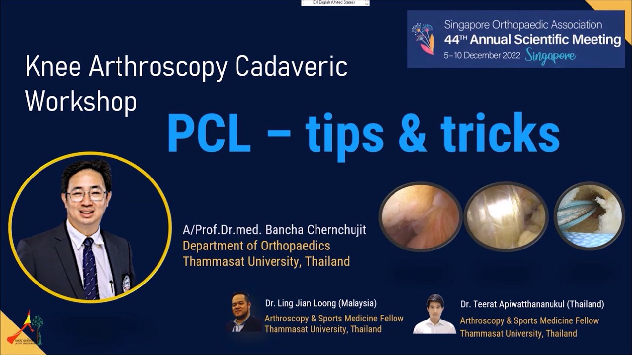 Tips Method Pcl PCL Reconstruction Tips Tricks SAO ASSA singapore - YouTube