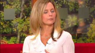 Alopecia Treatment from Universal Hair & Scalp Clinic, Dublin