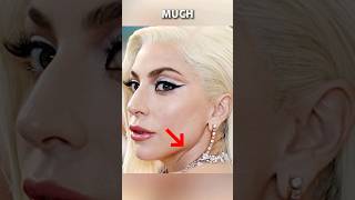 Did Lady Gaga Have Plastic Surgery?