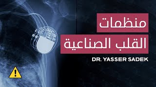 منظمات القلب الصناعية 💙 دكتور ياسر صادق