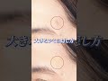大きなシミの隠し方！明るい色で隠すのは逆効果よ！プロ直伝「暗めコンシーラー×15秒固定」で素肌化する神ワザ✨
