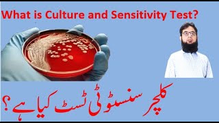What is Culture and Sensitivity Test II What is Culture and Sensitivity Test