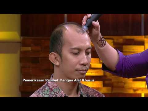 Video: Produk Ini Akan Memperbaiki Rambut Topi Anda