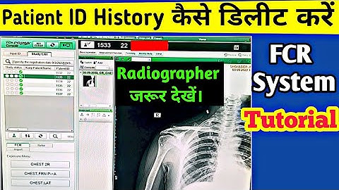 How to Delete Patient ID History on FCR System | Fujifilm CR System Tutorial | Uday XRay