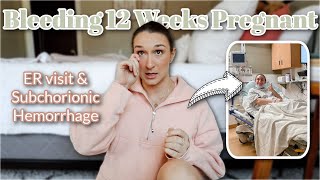 My Subchorionic Hematoma &amp; Hemorrhage Experience | 1st &amp; 2nd Trimester | Bleeding in Pregnancy