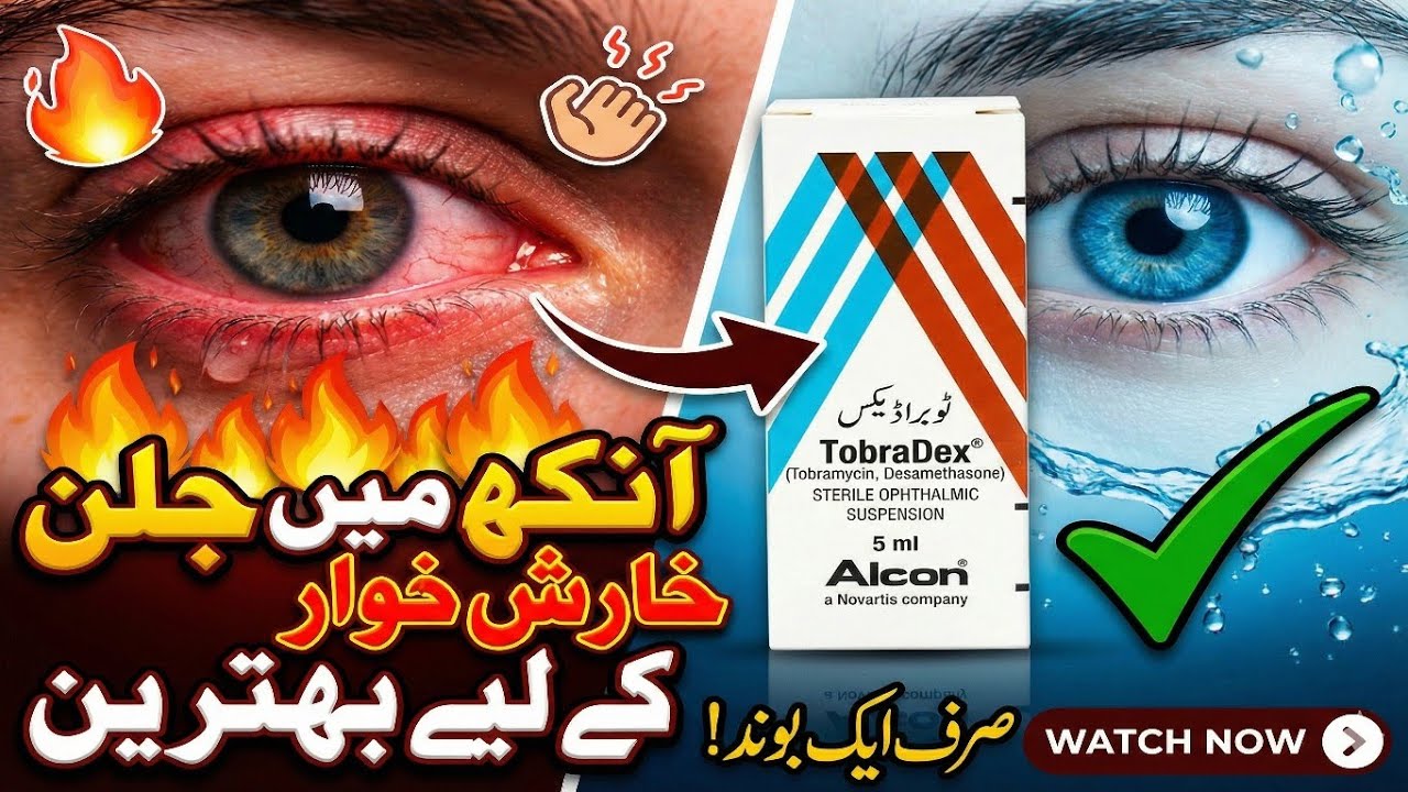 Tobradex Eye Drops Uses in Urdu | Tobra D Eye Drops Price in Pakistan | Tobramycin Eye Drops