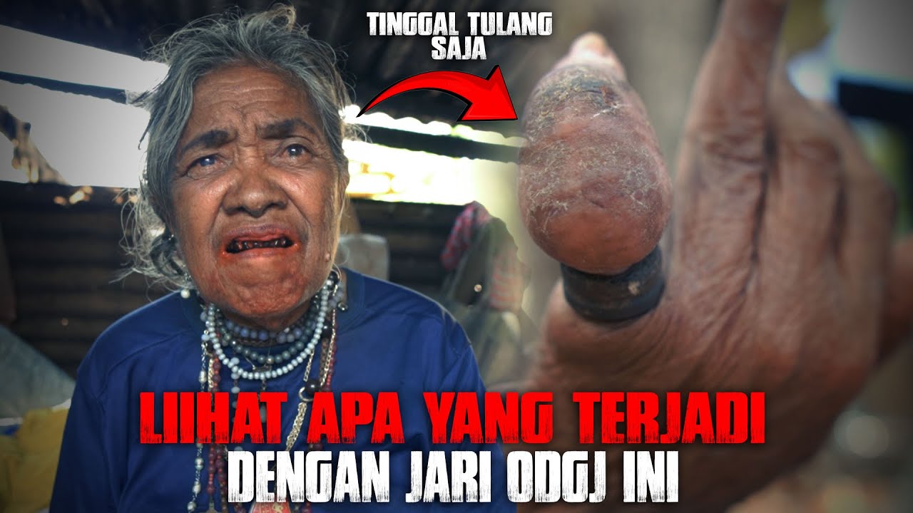 Merinding !! Lihat apa yang terjadi setelah cincin yang ada di Jari ODGJ ini dilepas !!?