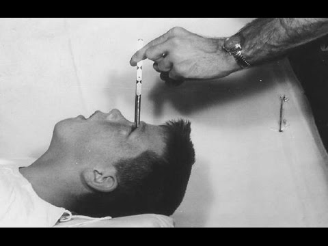25 Craziest Medical Treatments In History