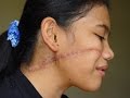 Religious Persecution And Hostility On The Rise In Indonesia