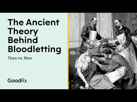 Bloodletting (Phlebotomy) Through