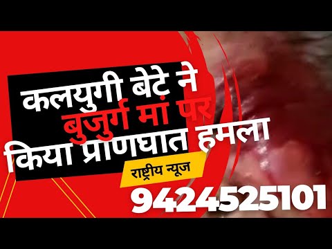 कलयुगी बेटे ने बुजुर्ग मां पर किया जान लेवा हमला