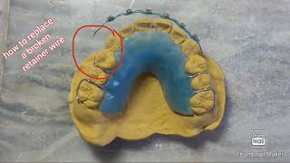 How to Replace a broken retainer wire