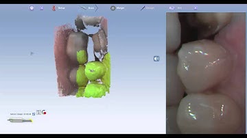 #3 Planscan Color Scanning