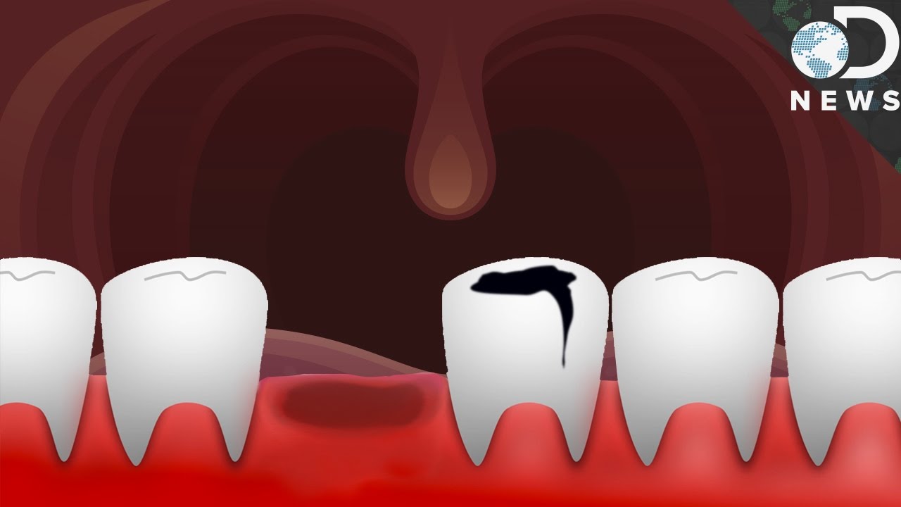 Can Teeth Repair or Regrow Themselves?
