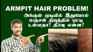 அககள மடயல ஒடடயரககம ஒரவத அழகக எபபட நம தரவ கணபத? Armpit Hair Problem