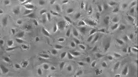 Primary Endothelial Cell Culture in Cellix