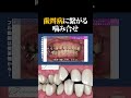 歯磨きだけでは解決しない歯周病の原因とは?(Part2)【歯科医師が語る】